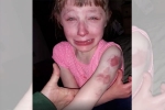 Lilly, Lynn Waldron-Moehle, 10 year old special needs child brutally bitten on arm while returning home in school bus, Special needs