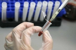 Human Antibodies To Combat Ebola, Human Antibodies To Fight Ebola, new human antibodies to combat ebola, Ebola outbreak