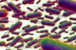 E.coli Outbreak UK, E.coli Outbreak deaths, all about e coli outbreak in the united kingdom, Tesco