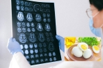 Eggs and Alzheimer’s breakfast, Eggs and Alzheimer’s study, eggs may help prevent alzheimer s study, Who