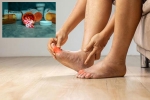 Gout Drugs latest update, Gout Drugs news, gout drugs may cut the risk of heart attack, United states