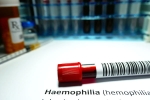 Hemophilia for men, Hemophilia breaking, why are men likely to develop hemophilia, Therapy