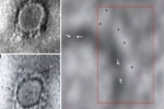 ICMR, scientists, indian scientists reveal images of the novel coronavirus under a microscope, Indian scientist