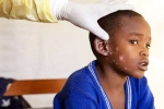 Monkeypox Outbreak news, Monkeypox Outbreak cases in India, is monkeypox outbreak coming to india, Icmr