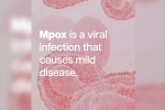 who on mpox, mpox cases, mpox emergency again, Back pain