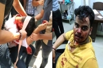 Harsh Yadav attack, Nodia Amity attack, social media demands justice for two noida students who are brutally attacked, Feminism