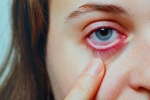 Conjunctivitis treatment, Conjunctivitis videos, special measures to prevent conjunctivitis, Conjunctivitis