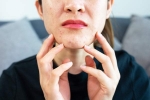 Stress Acne symptoms, Stress Acne news, does your regular routine cause you acne, Stress acne