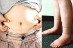 Water Retention prevention, Water Retention human body, some effective ways to reduce water retention, Heart diseases