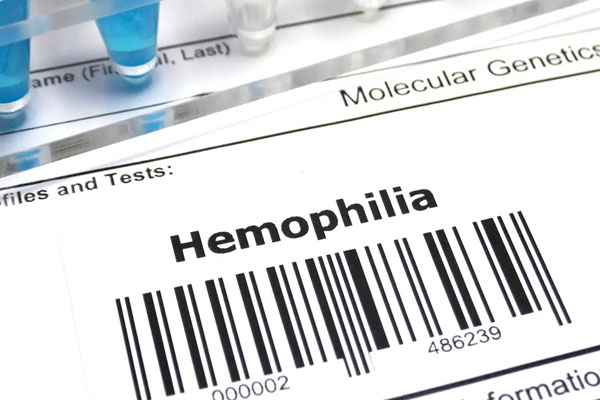 Essential Tips when you are travelling with Haemophilia