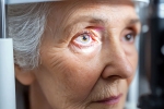 Glaucoma, Glaucoma eye disease, all about the eye disease glaucoma, Doctor